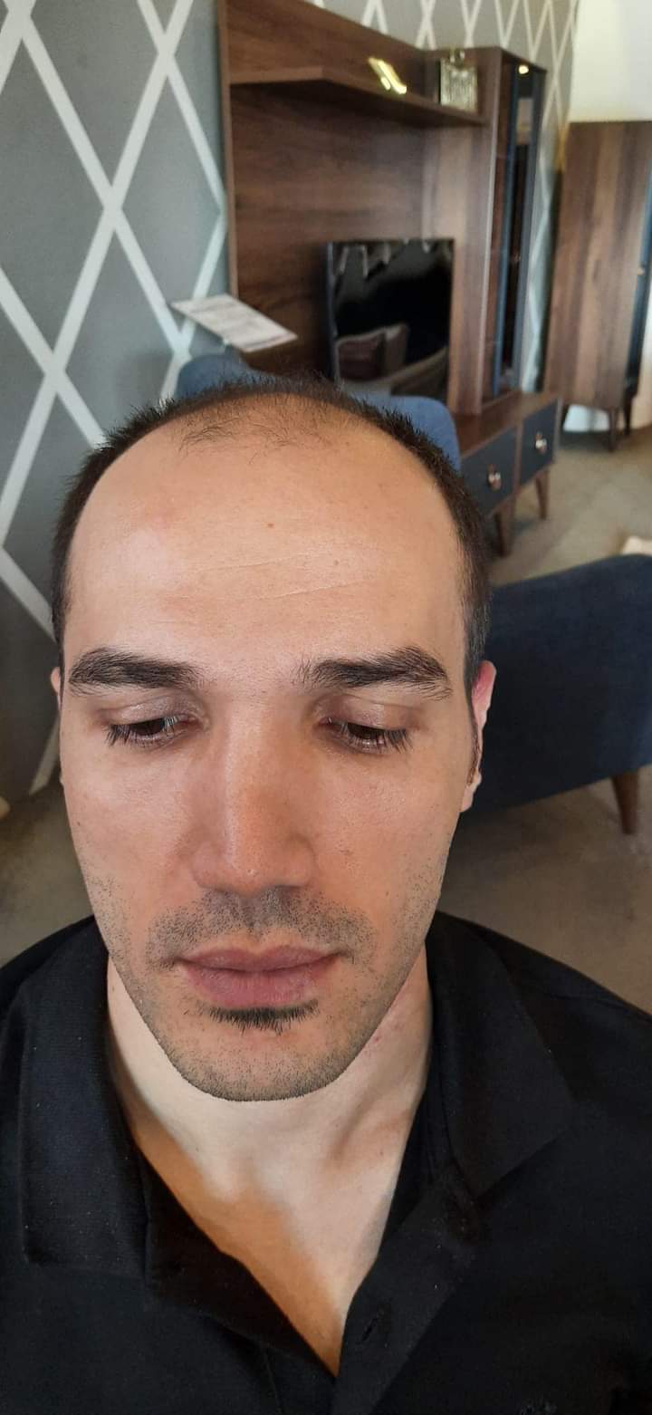 1000177495.jpg