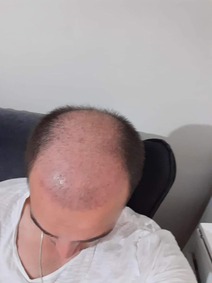 1000177502.jpg
