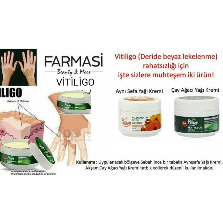 Farmasi vitiligo kremi kullananlar var mı.jpg