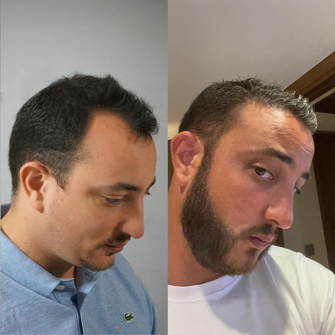 saçsakalekimi.jpeg