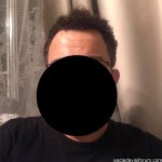 5500 kök saç ekimi.jpg