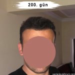 maya istanbul saç ekimi.jpg