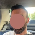 zen klinik saç ekimi.jpg