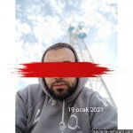 saç ekimi kıbrıss.jpg