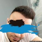 7.ay saç ekimi .jpg