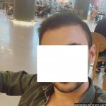 6000 greft saç ekimi.jpg
