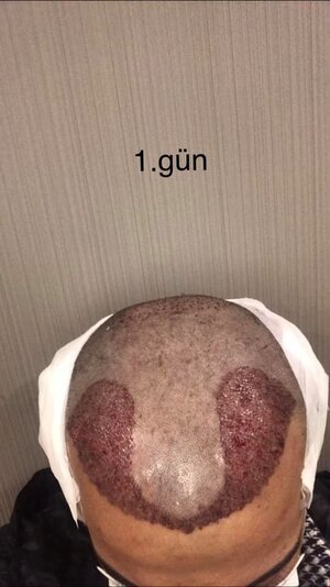 serkan aygın 1. gün.jpeg